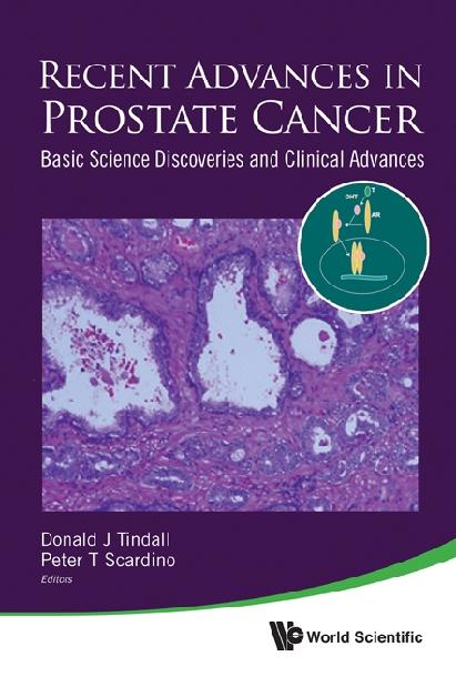 RECENT ADVANCES IN PROSTATE CANCER by Scardino Peter T, Tindall Donald J