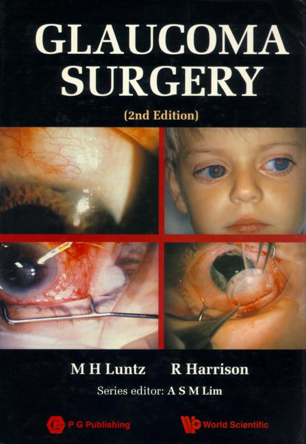 GLAUCOMA SURGERY (2ND EDITION) by Harrison Raymond, Luntz Maurice H