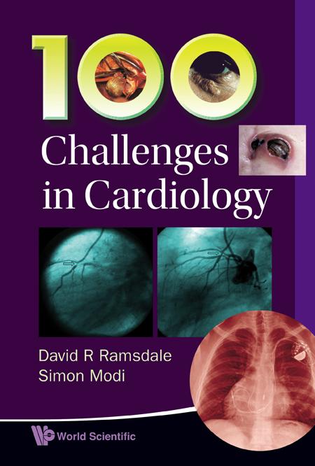100 CHALLENGES IN CARDIOLOGY by David R Ramsdale, Simon Modi