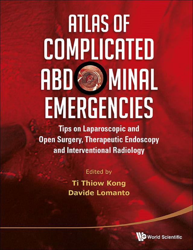ATLAS COMPLICAT ABDOMINAL (W/DVD) by Davide Lomanto, Thiow Kong Ti