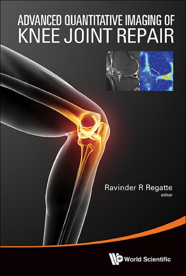ADVANCED QUANTITATIVE IMAGING OF KNEE JOINT REPAIR by Ravinder R Regatte