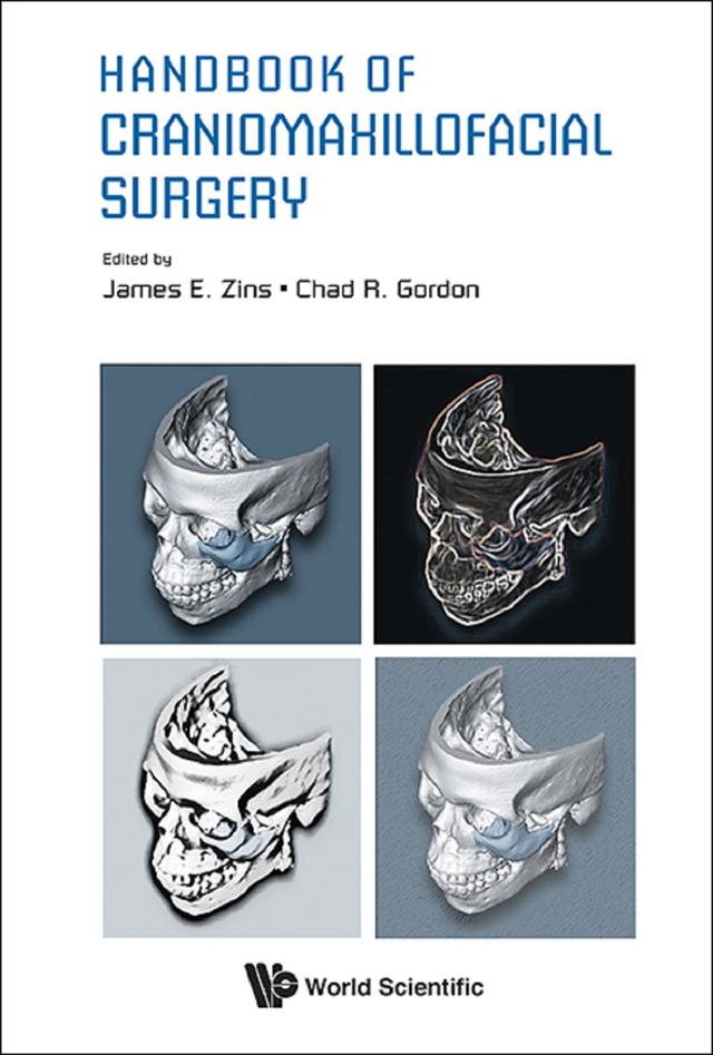 HANDBOOK OF CRANIOMAXILLOFACIAL SURGERY by Chad Ronald Gordon, James E Zins