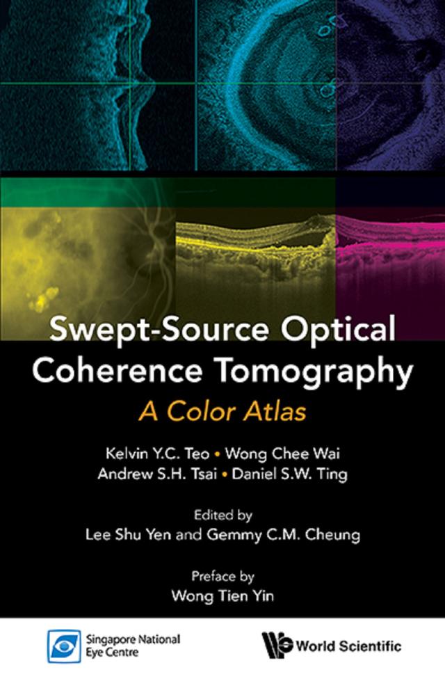 SWEPT-SOURCE OPTICAL COHERENCE TOMOGRAPHY: A COLOR ATLAS by Andrew Shih Hsiang Tsai, Chee Wai Wong, Daniel Shu Wei Ting, Gemmy Chui Ming Cheung, Kelvin Yi Chong Teo, Shu Yen Lee