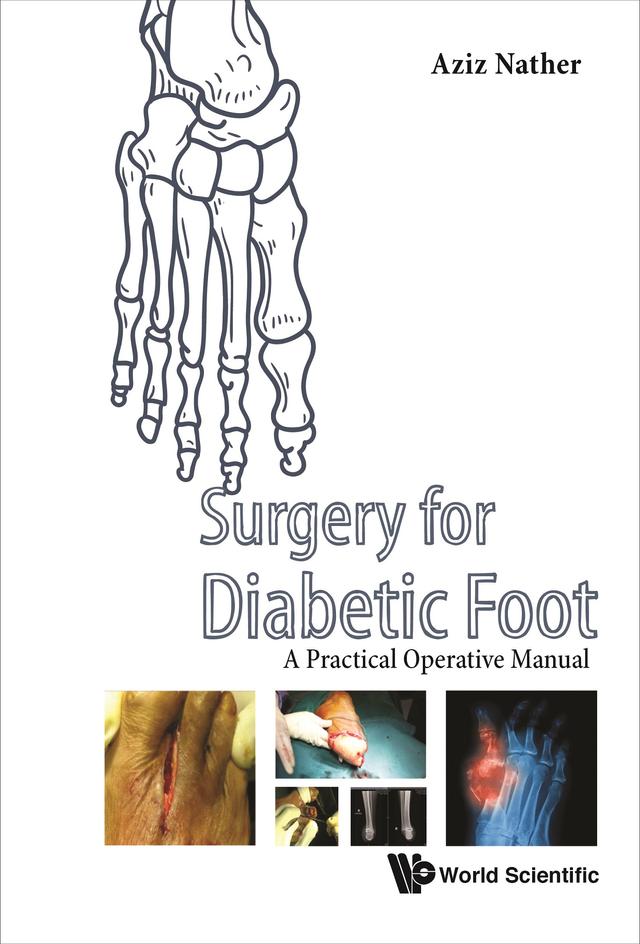 SURGERY FOR DIABETIC FOOT by Abdul Aziz Nather